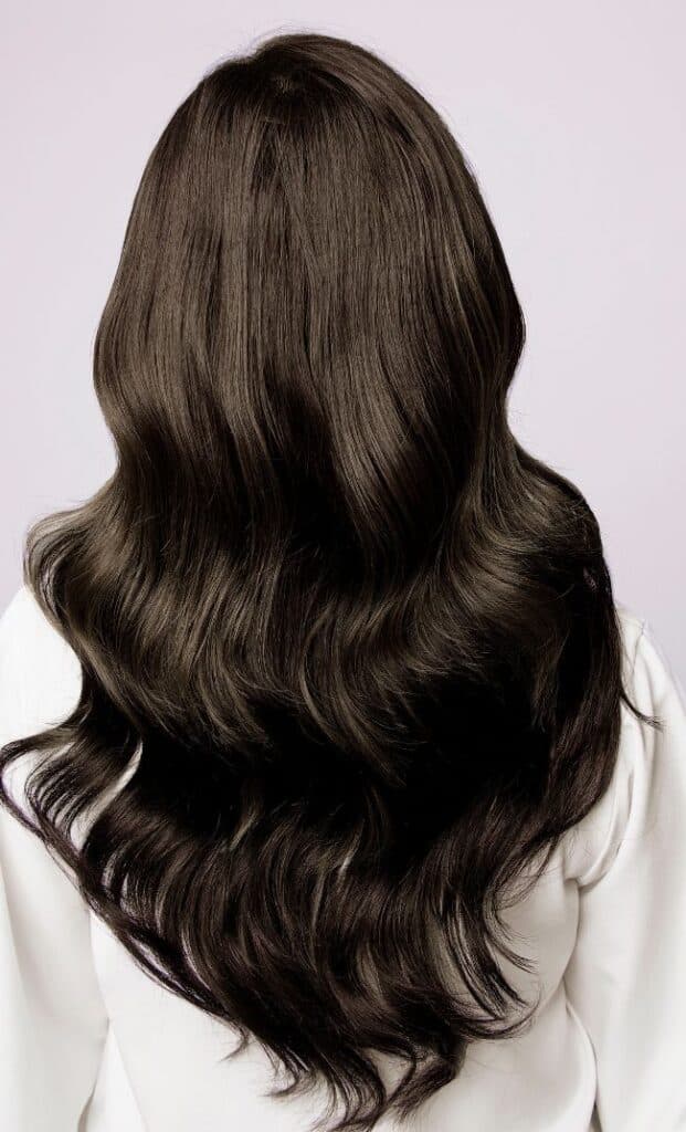 Female patient before and after hair transplant showing natural density