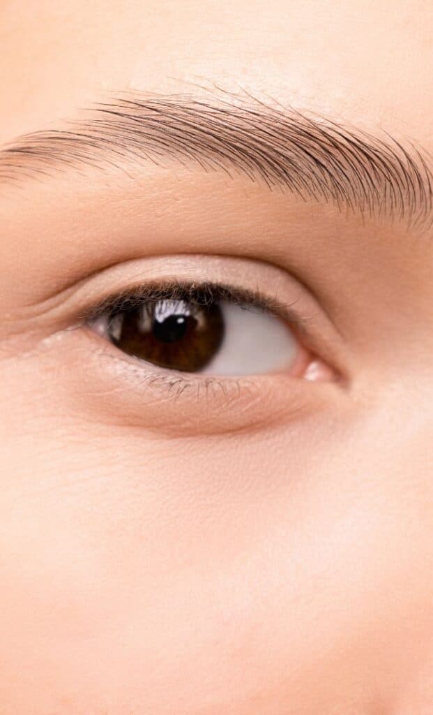 Natural eyebrow transplant before after showing fuller eyebrows results