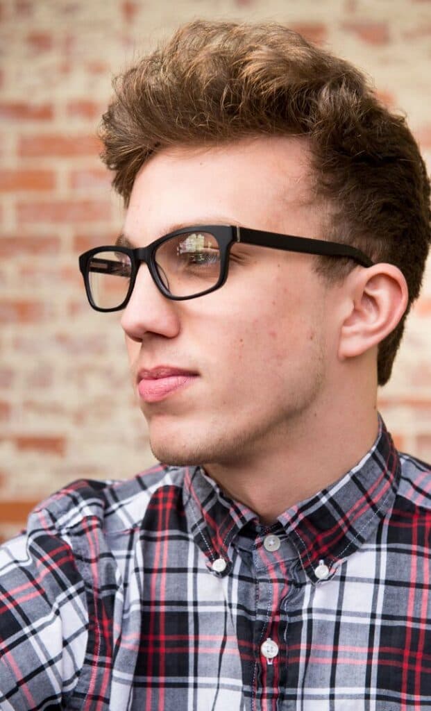 Male patient before and after hair transplant procedure showing results